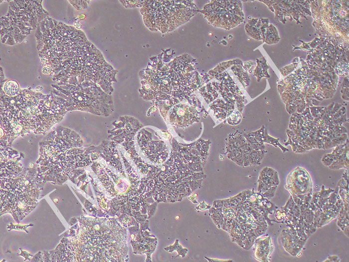 LS1034人结肠腺癌细胞(STR鉴定正确)