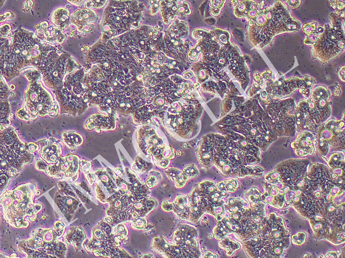 Ls513人结直肠癌细胞(STR鉴定正确)