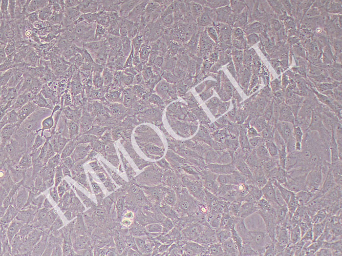 大鼠髁突软骨细胞