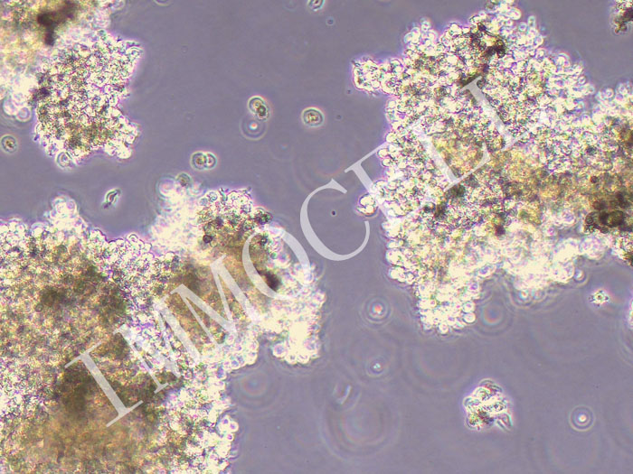 Hs-611.T人霍奇金淋巴瘤细胞