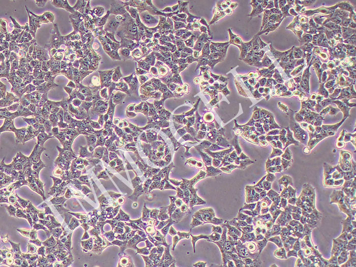 KYSE-70人食管鳞状细胞癌细胞(STR鉴定正确)