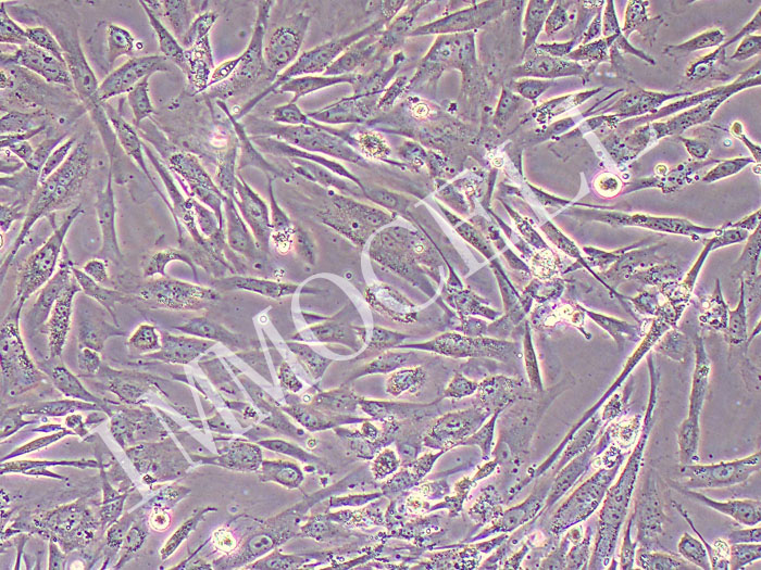 HPASMC-SV40T人肺动脉平滑肌细胞永生化