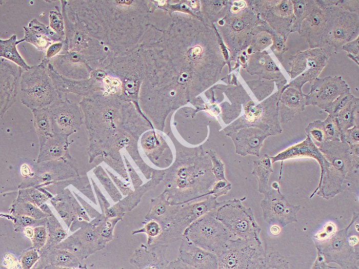 OVCAR-4人卵巢癌细胞