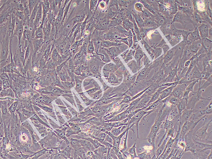 人巩膜成纤维细胞（永生化）