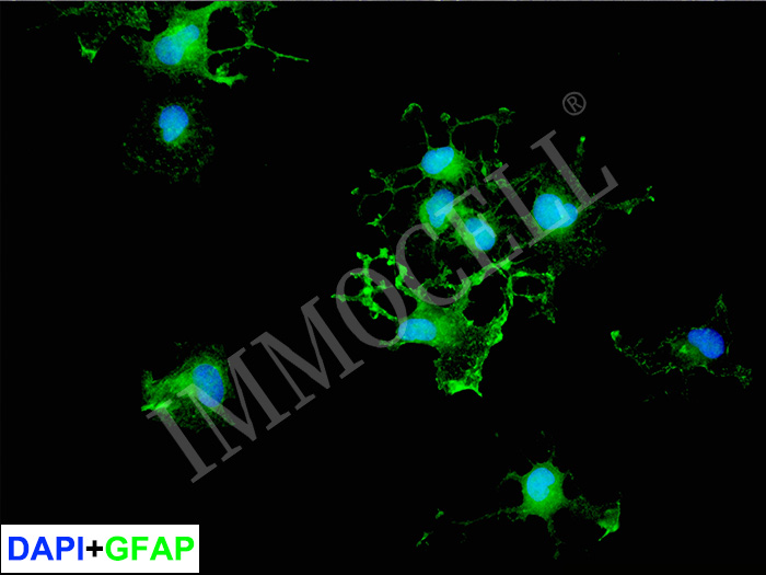 hPSC(iPSC)来源星形胶质细胞 iAST(iPSC)