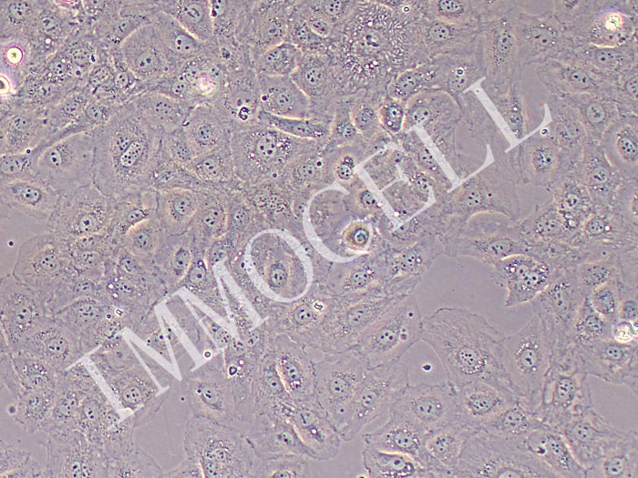 K1人甲状腺癌细胞