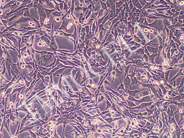 PANC02小鼠胰腺癌-肝转移成纤维细胞永生化（STR鉴定正确）
