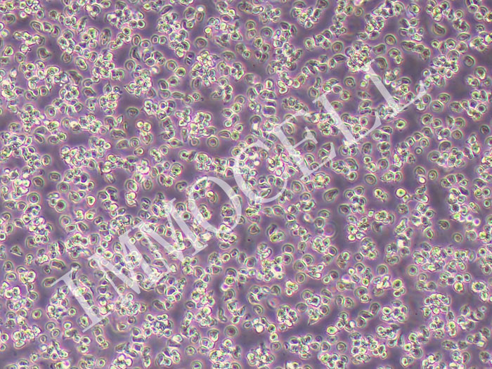 HPB-ALL人急性T淋巴细胞白血病-幼儿（STR鉴定正确）