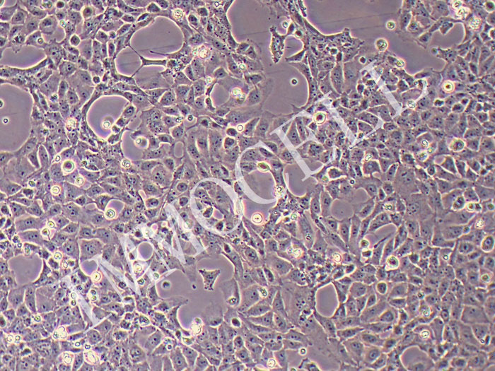 大鼠心脏微血管内皮细胞永生化