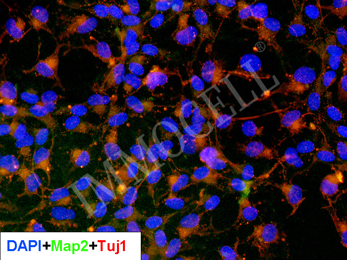 hPSC(hiPSC)来源皮质神经元iCN(hiPSC)