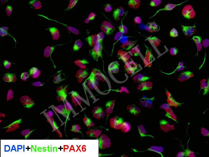 hPSC来源前脑神经干祖细胞(iPSC) fNSPC(iPSC)