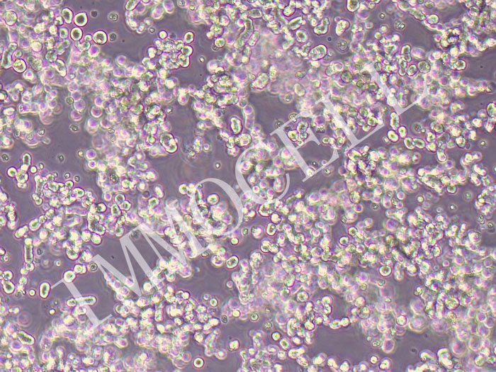 LASCPC-01人神经内分泌分化的前列腺腺癌细胞（STR鉴定正确）