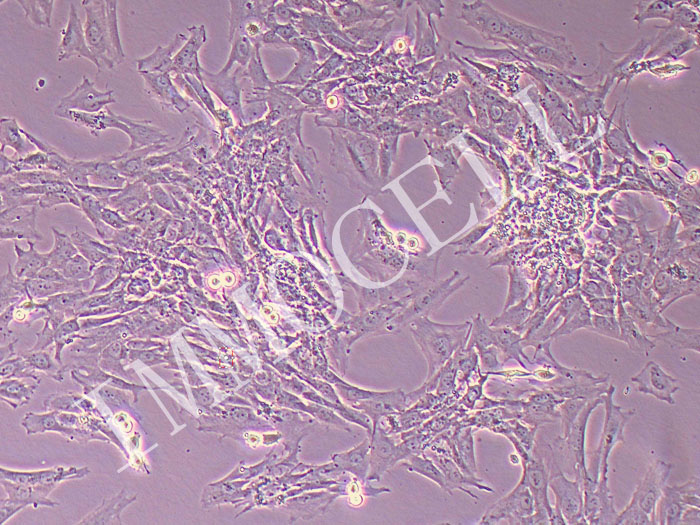 大鼠结肠平滑肌细胞永生化