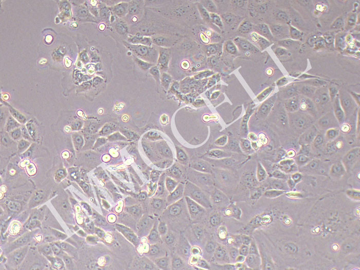 HCerEpiCs-hTERT人宫颈上皮细胞永生化