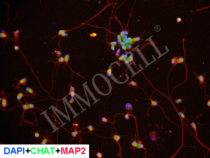 hPSC来源运动神经元细胞iMN(iPSC)