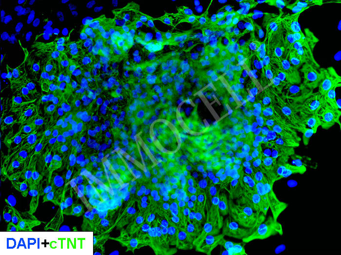 hPSC来源心肌细胞iCM-iPSC