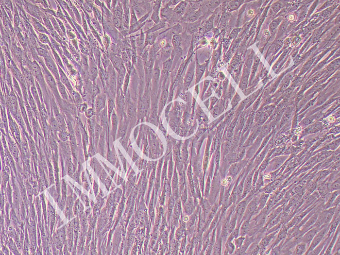 人食管成纤维细胞永生化