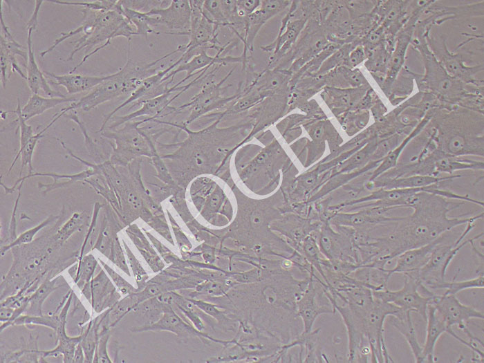 人原代眼眶成纤维细胞