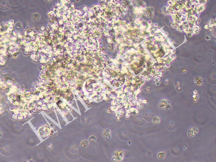 NCI-H889人小细胞肺癌细胞（STR鉴定正确）