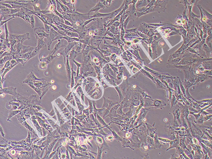 HBZY-1大鼠肾小球系膜细胞(STR鉴定正确)