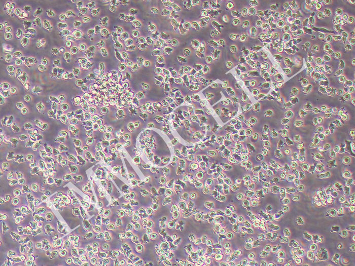 HMy2.CIR人B淋巴母细胞