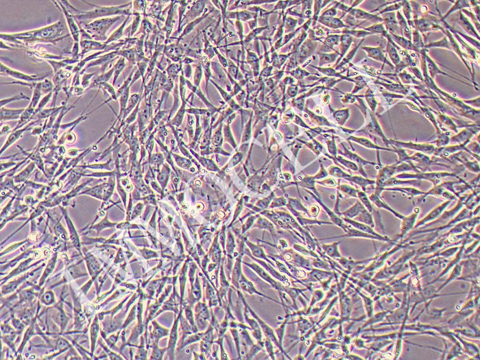 人口腔黏膜成纤维细胞永生化