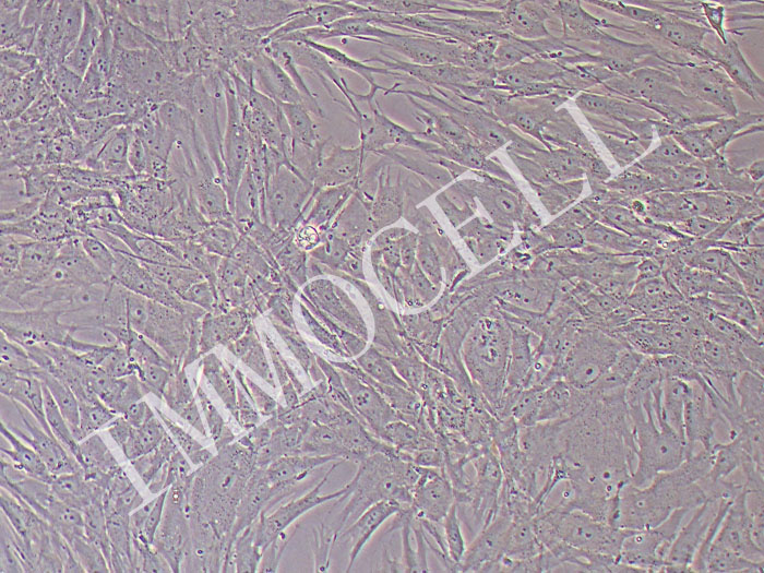 人结膜成纤维细胞