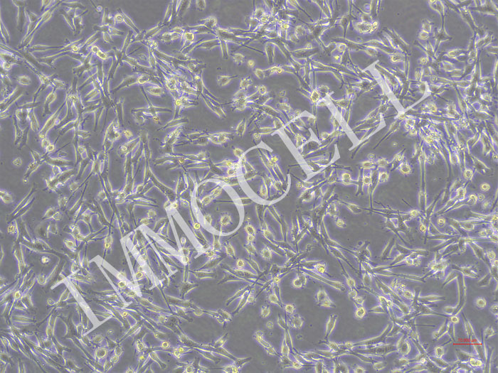 ICC-X2-Fluc-puro人肝内胆管癌细胞