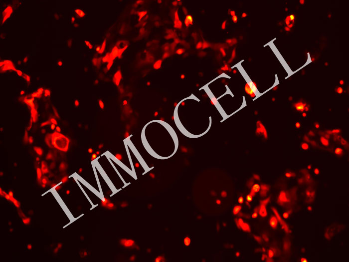 PDAC-X1-mScarlet3-puro人胰腺癌细胞