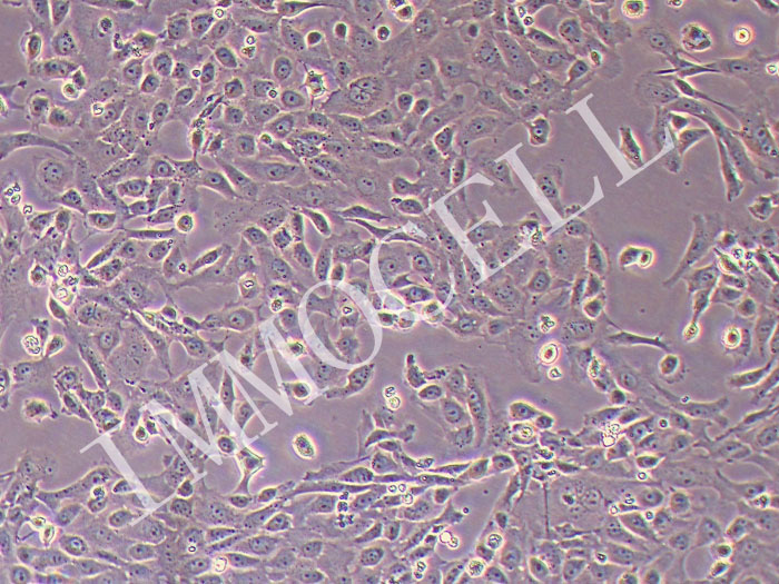 大鼠肺动脉内皮细胞永生化
