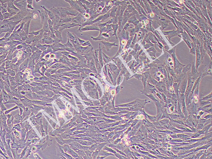 大鼠子宫平滑肌细胞永生化