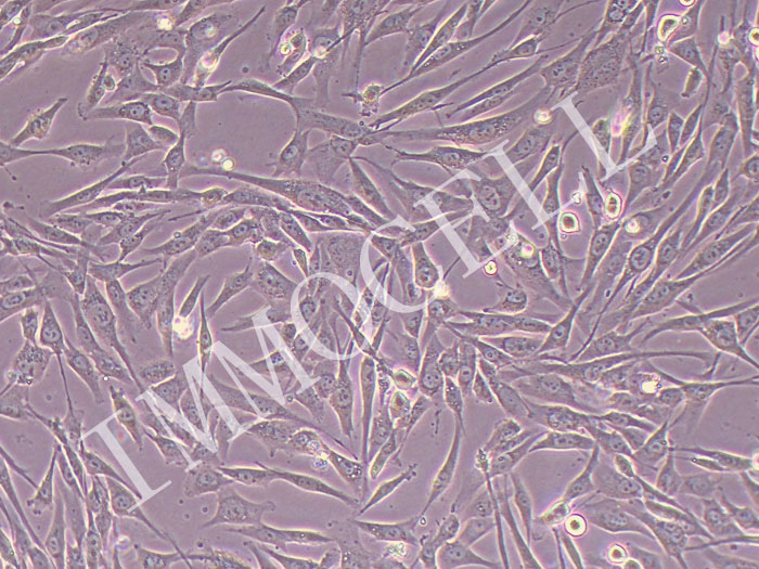 子宫内膜基质细胞永生化