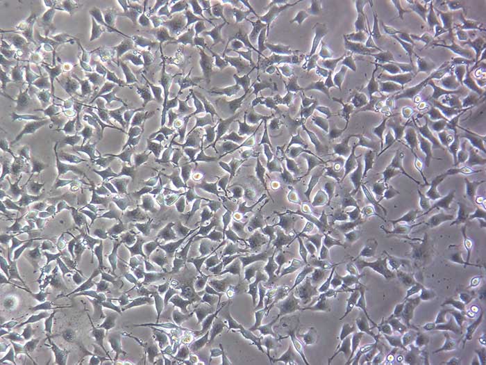 B16F10细胞细胞图片