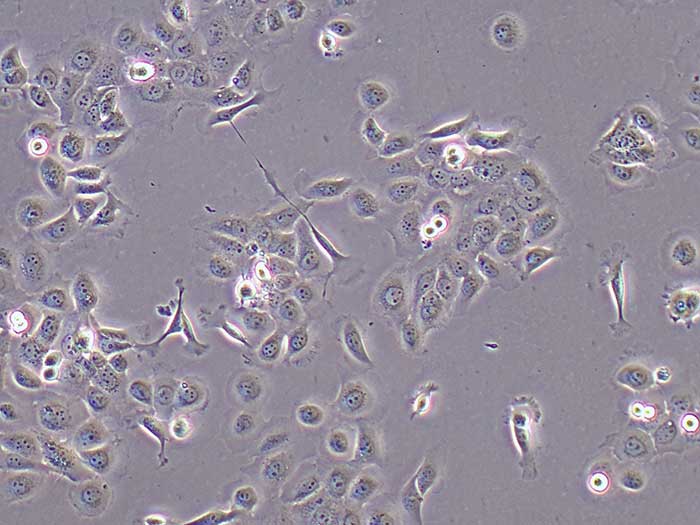CASKI细胞图片