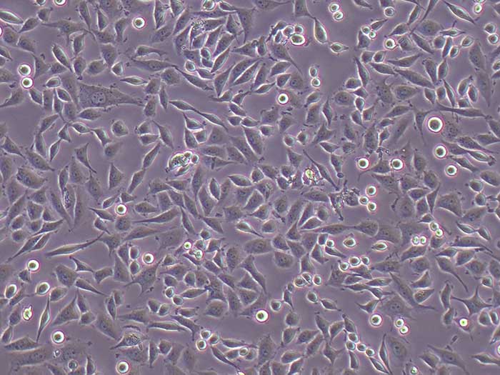 SiHa细胞图片