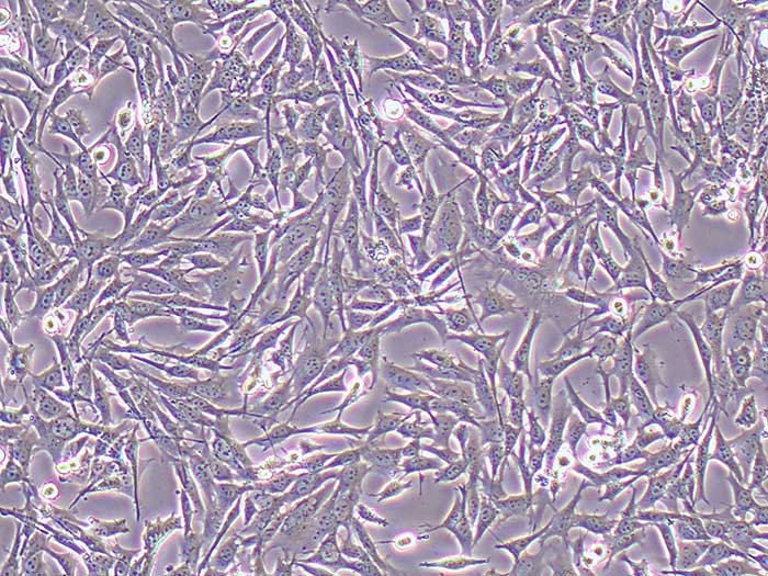 HT22细胞(小鼠海马神经元细胞)-逸漠细胞库