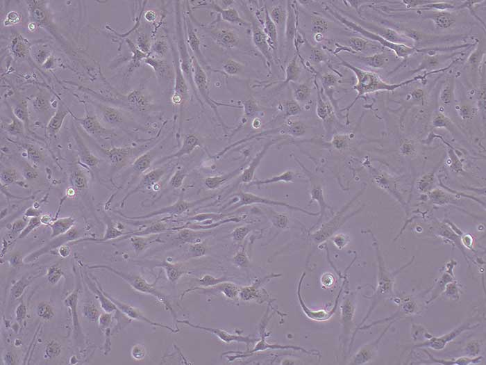 Bend.3细胞细胞图片