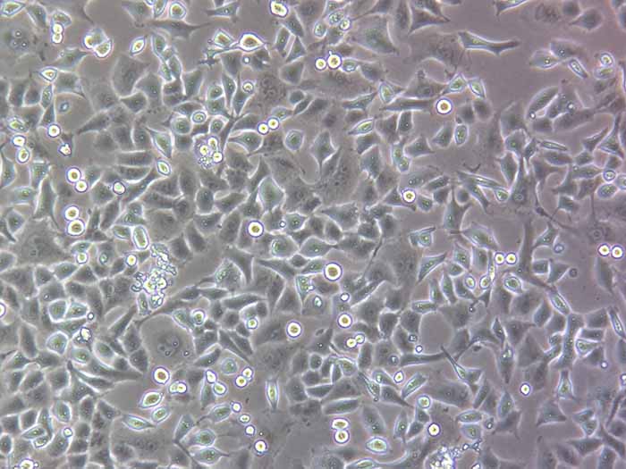 PANC-1细胞细胞图片
