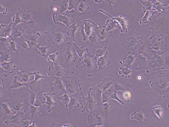 HS578T细胞细胞图片
