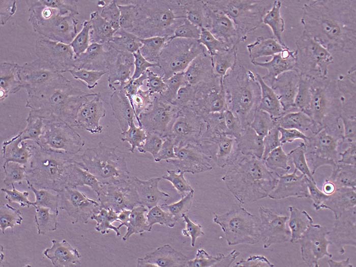 HS578T细胞图片