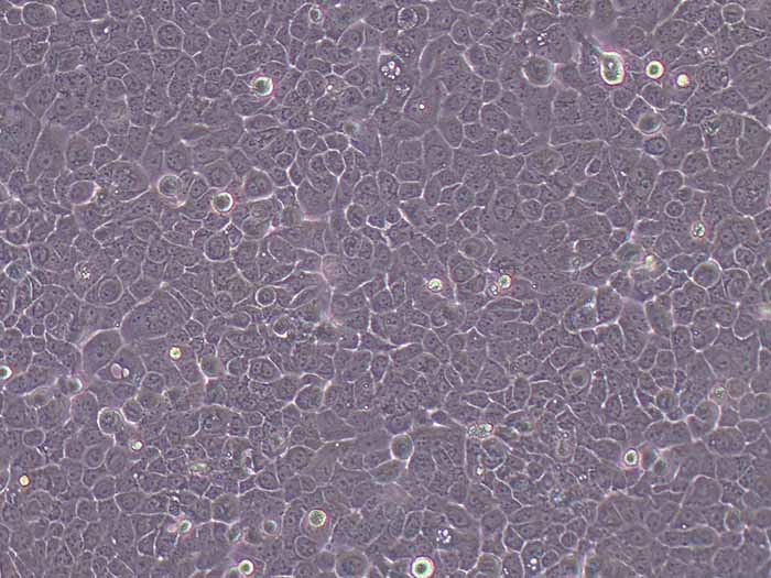A431细胞细胞图片