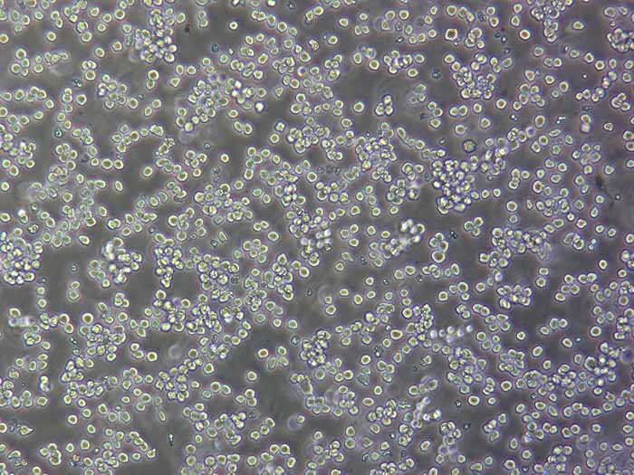 NB4细胞细胞图片