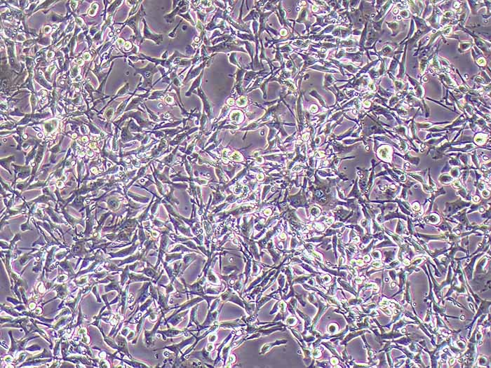 STC-1细胞细胞图片