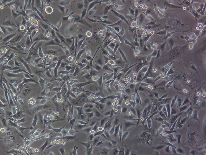 MDA-MB-231细胞细胞图片