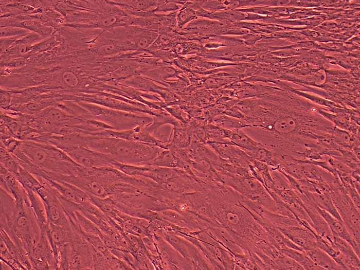HFF-1人包皮成纤维细胞图片