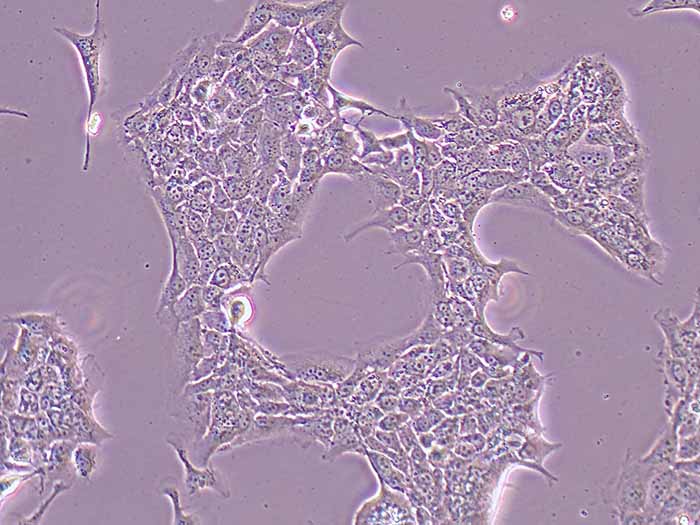 HCC827细胞细胞图片