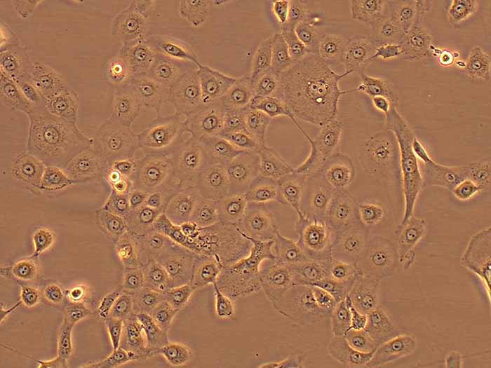 NCI-H1650细胞图片