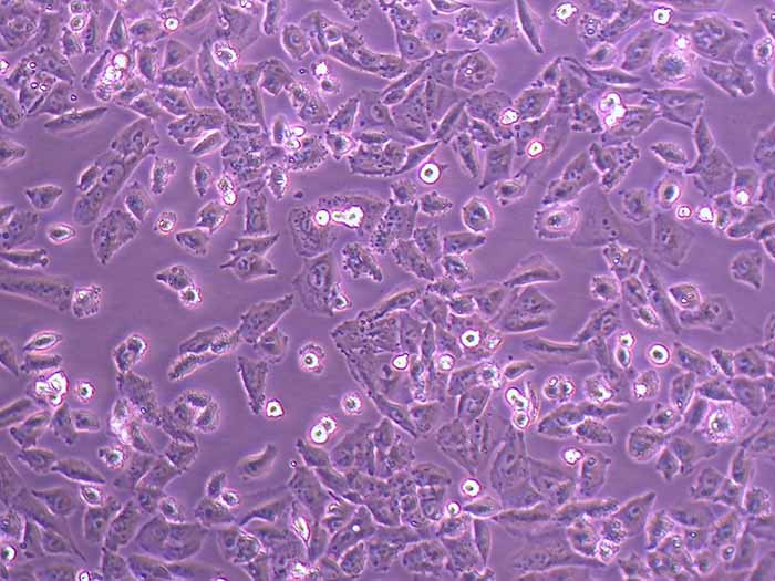 NCI-H1703细胞图片