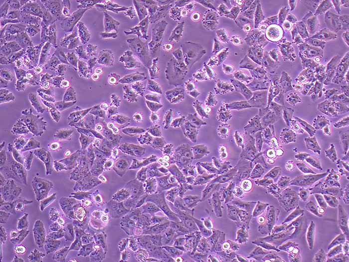NCI-H1703细胞图片