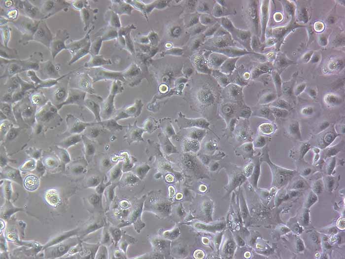 NCI-H226细胞细胞图片